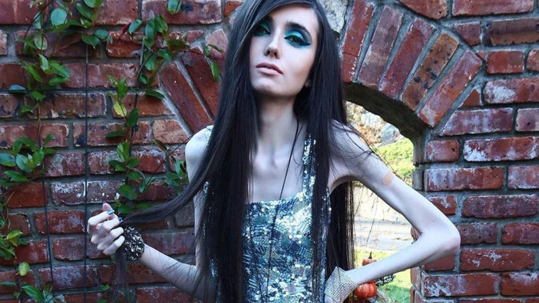 Skinny YouTuber Eugenia Cooney has a deathly relapse